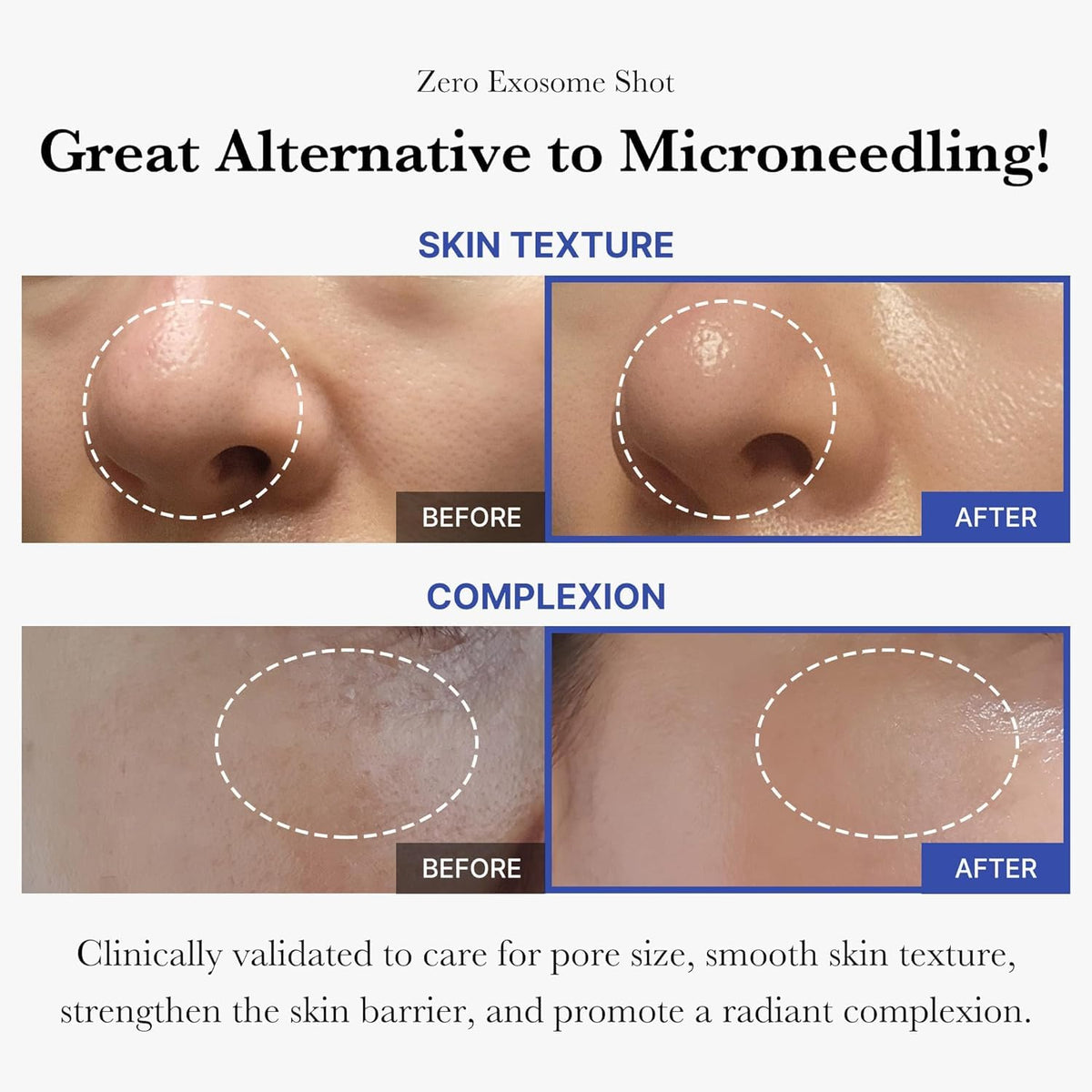Medicube Exosome Shot 2,000 PPM – Pore & Texture Refining Serum