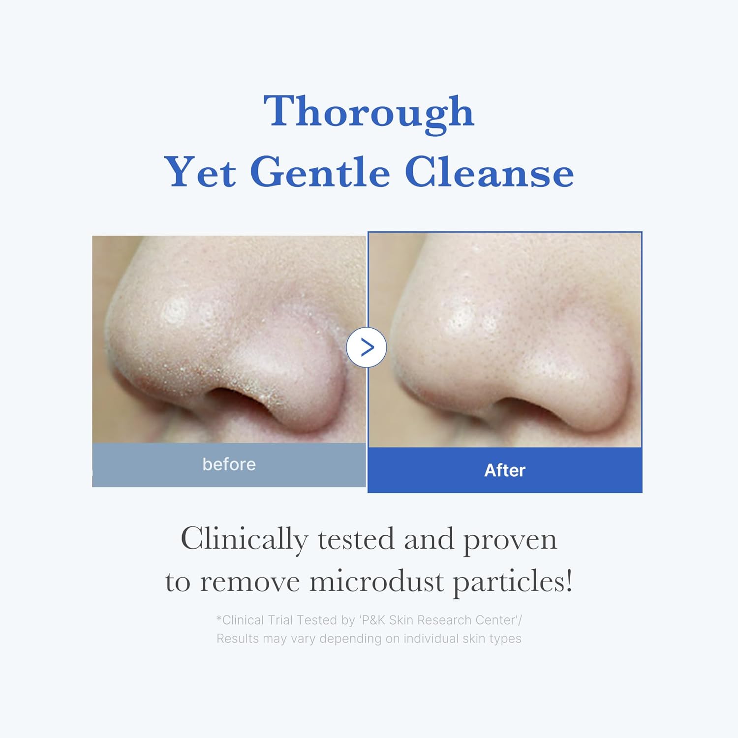 Medicube Zero Foam Cleanser | Gentle Pore Care Facial Cleanser
