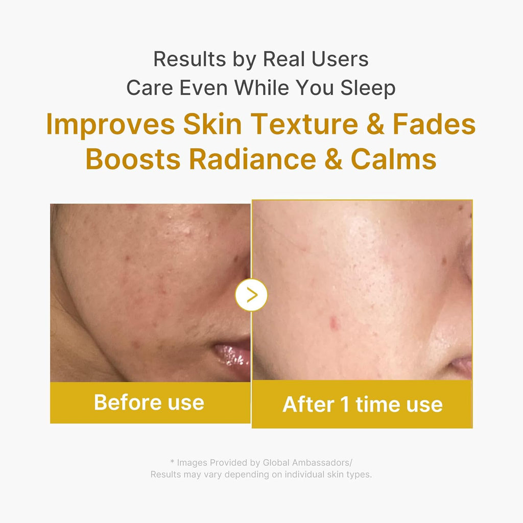 Medicube Kojic Acid Brightening Wrapping Mask | Overnight Peel-Off Facial Mask