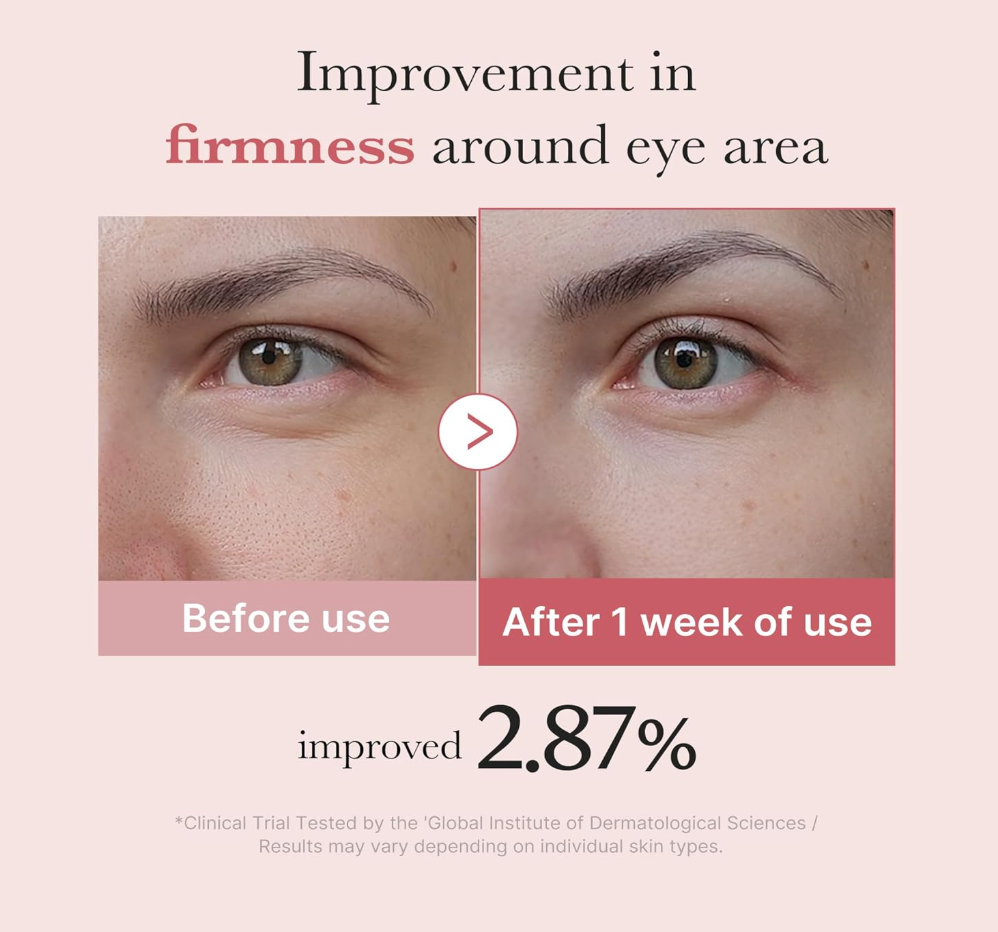 Medicube PDRN Pink Peptide Eye Serum – Firming & Hydrating Eye Care