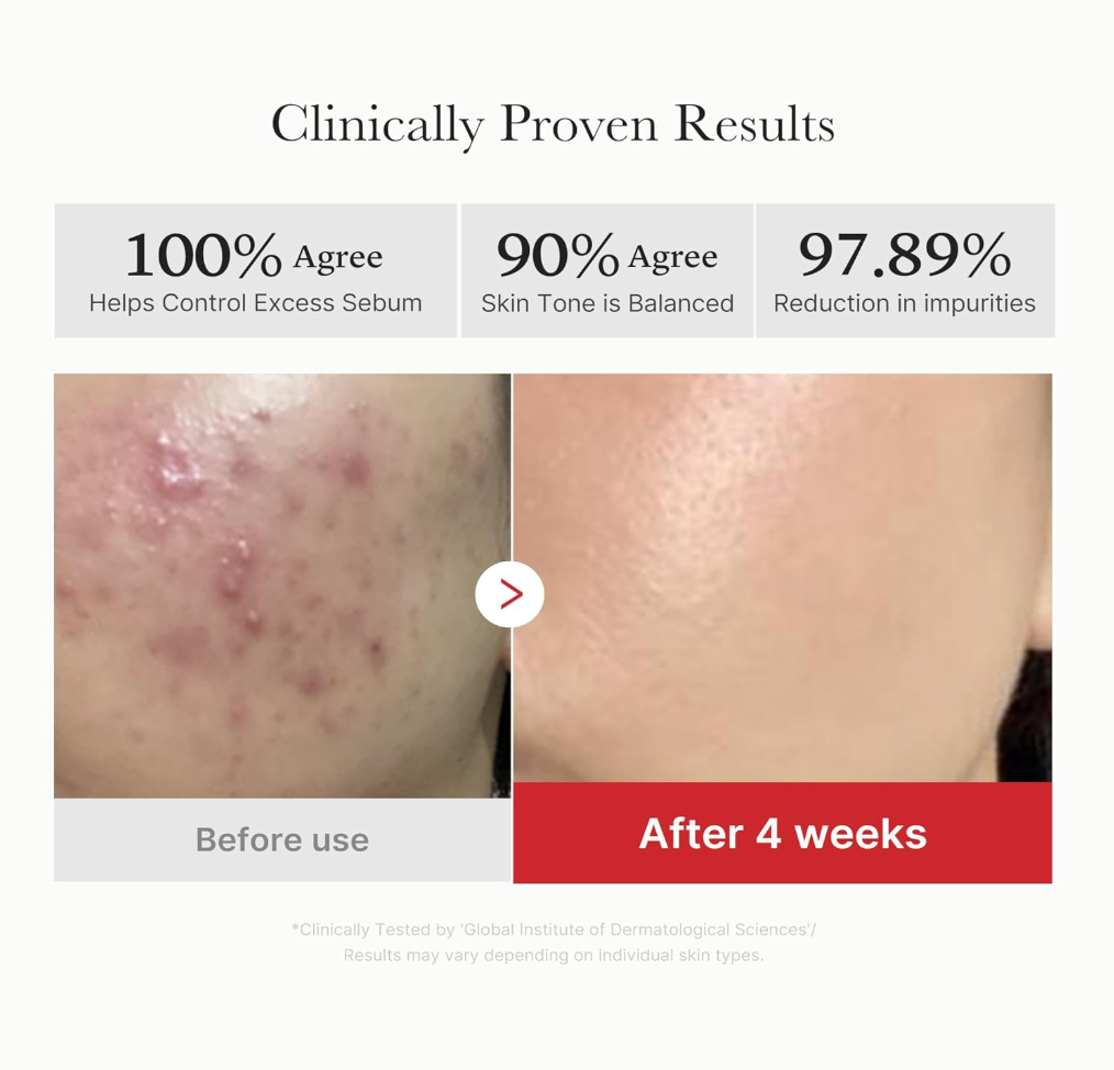 Medicube Red Succinic Acid Toner Pads – Exfoliating & Breakout Care