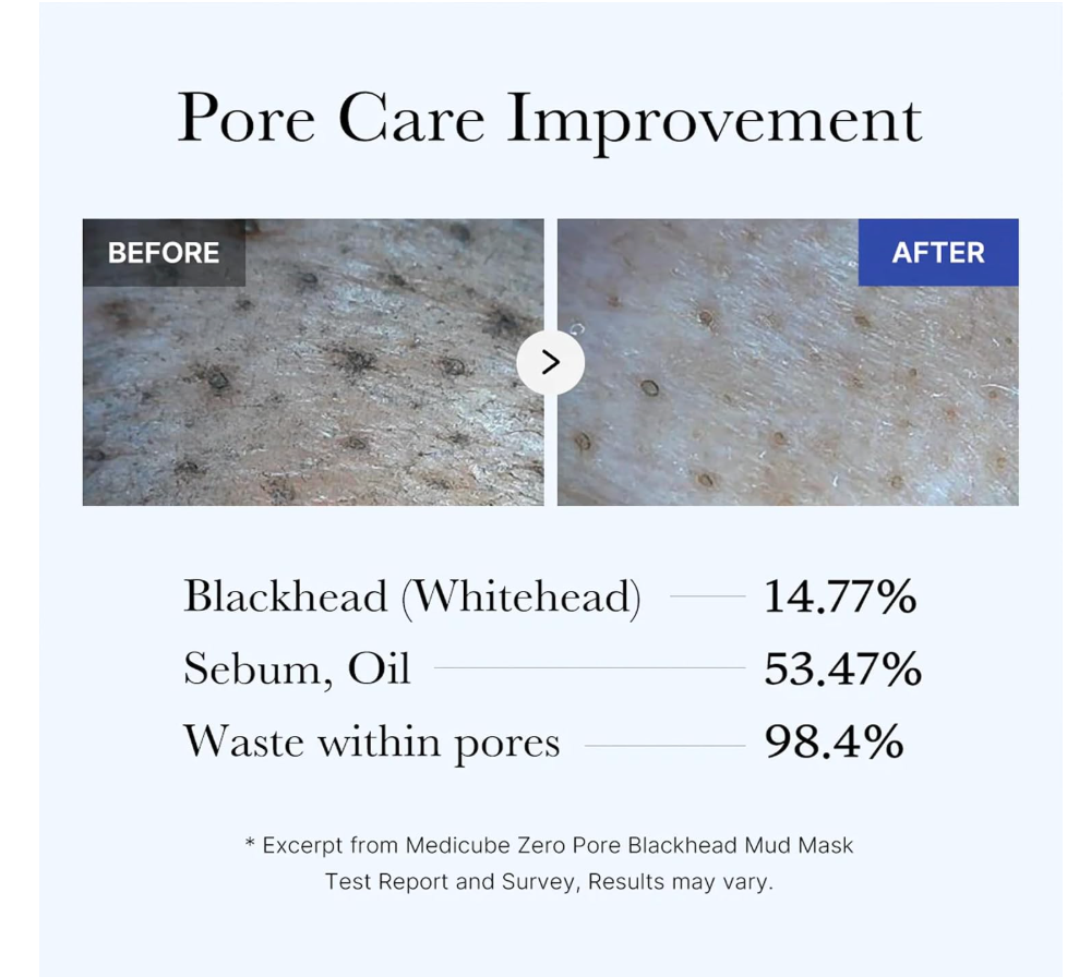 Medicube Zero Pore Blackhead Mud Mask – AHA, BHA & PHA Pore Cleansing Mask
