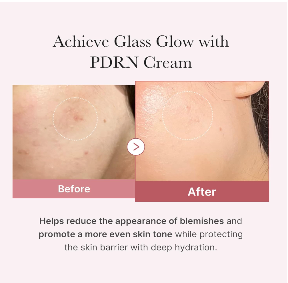 Medicube PDRN Pink Hyaluronic Moisturizing Cream – Hydration & Elasticity Care