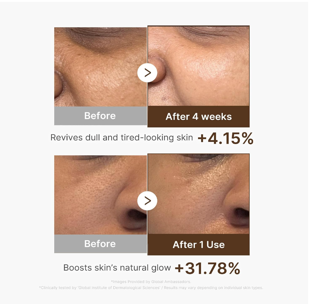 Medicube Deep Vitamin C Capsule Serum – Radiance & Uneven Tone Care