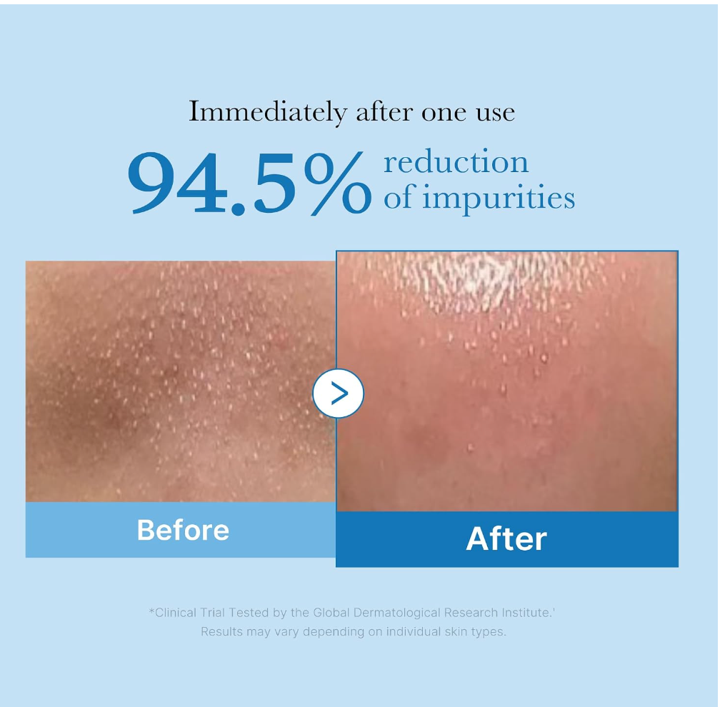 Medicube Zero Pore Blackhead Cleansing Oil – Makeup & Pore Cleansing Care